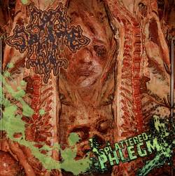 Toiletgurgling Fecal Shower : Splattered Phlegm - Hemorrhoidal Milk Enema